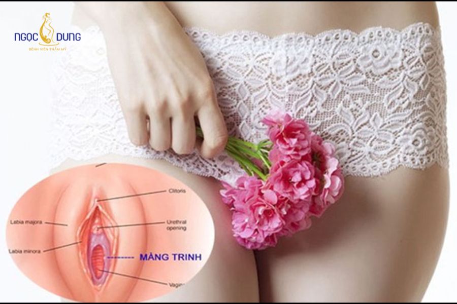 Rách màng trinh chảy máu màu gì? Giải đáp chi tiết 7 Độ dày màng trinh, vị trí rách và cơ địa từng người quyết định mức độ cũng như thời gian chảy máu