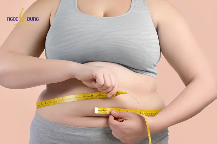 Hút mỡ có giảm cân không? Chuyên gia giải đáp chi tiết 14 Dư thừa calo và lười vận động là những nguyên nhân hàng đầu làm tích tụ mỡ mới