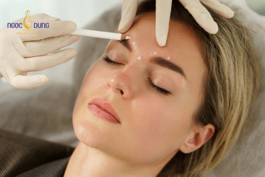 Tiêm tan filler bao lâu thì tan hết? Giải đáp chi tiết 11 Khuyến nghị chờ tối thiểu 2 tuần sau khi tiêm tan để vùng mô ổn định trước khi tiêm filler phom mới