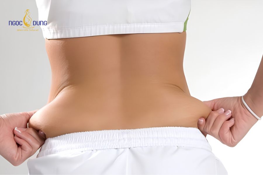 Hút mỡ hai bên hông: Giải pháp sở hữu vòng eo thon gọn 10 Kỹ thuật phẫu thuật hút mỡ hông eo bằng ống nội soi chuyên dụng qua vết trích siêu nhỏ