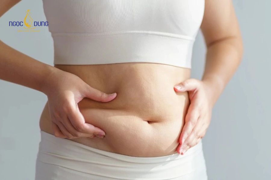 Hút mỡ có béo lại không? Cách duy trì vóc dáng dài lâu 6 Lười vận động sau khi vùng tổn thương đã ổn định làm giảm tốc độ tiêu hao năng lượng dư thừa