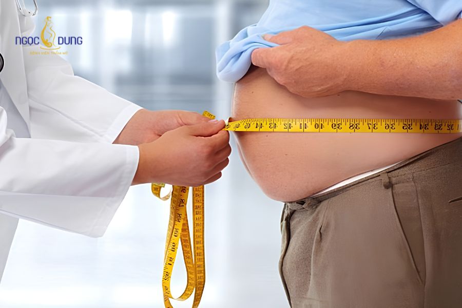 Hút mỡ có giảm cân không? Chuyên gia giải đáp chi tiết 13 Người đang béo phì hoặc có bệnh nền chưa kiểm soát không nên thực hiện phẫu thuật hút mỡ