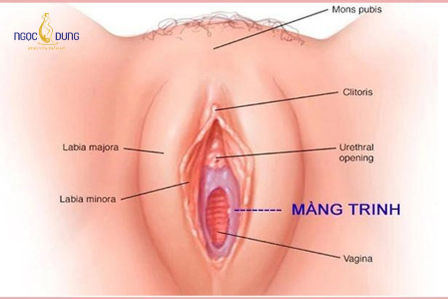 Màng trinh có tự lành được không? Giải đáp chi tiết 9 Sơ đồ vị trí màng trinh nằm trong tiền đình âm đạo của phụ nữ