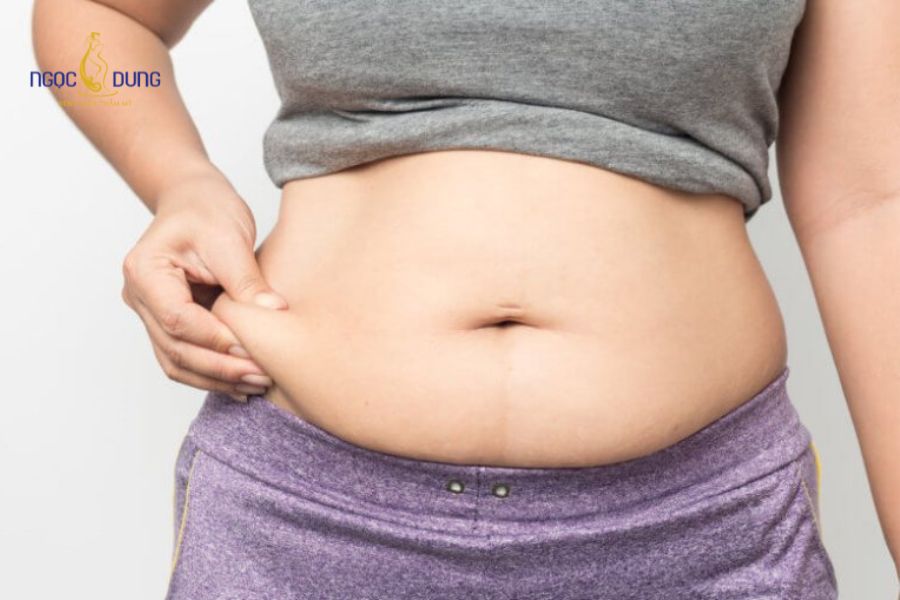 Có nên hút mỡ bụng sau sinh không? Giải đáp chi tiết 15 Sự thay đổi nội tiết tố và quá trình giãn nở tử cung trong thai kỳ khiến mô da bụng chùng nhão và tích mỡ