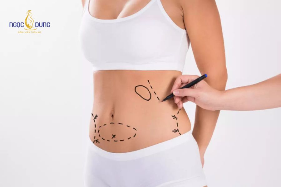 Hút mỡ có giảm cân không? Chuyên gia giải đáp chi tiết 15 Tái khám định kỳ theo chỉ định của bác sĩ để theo dõi tiến trình hồi phục toàn diện