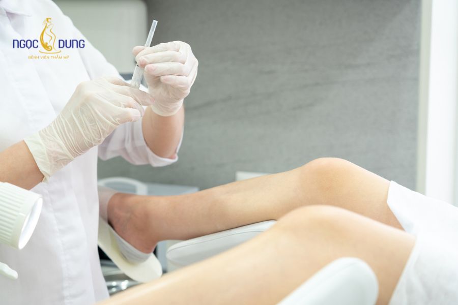 Tiêm filler vùng kín: Giải pháp thẩm mỹ an toàn y khoa 13 Tiêm filler vùng kín là thủ thuật thẩm mỹ nội khoa diễn ra nhanh chóng, ít xâm lấn và không mất nhiều thời gian nghỉ dưỡng