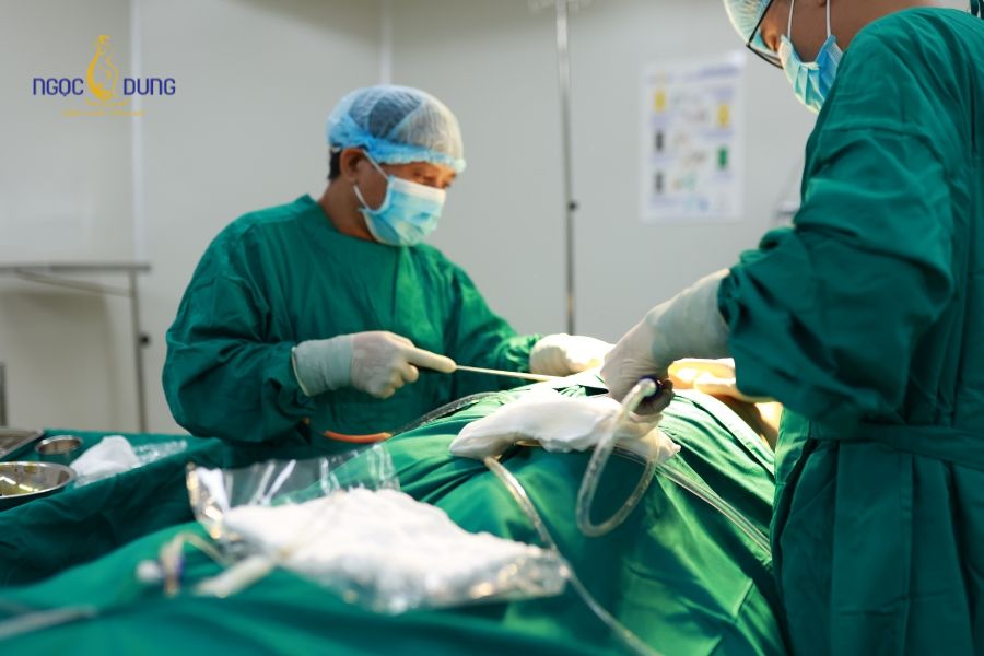 Chi phí hút mỡ bắp chân bao nhiêu? Bảng giá mới nhất 11 Trình độ tay nghề bác sĩ chuyên khoa và hệ thống phòng mổ vô trùng là yếu tố quan trọng quyết định mức giá