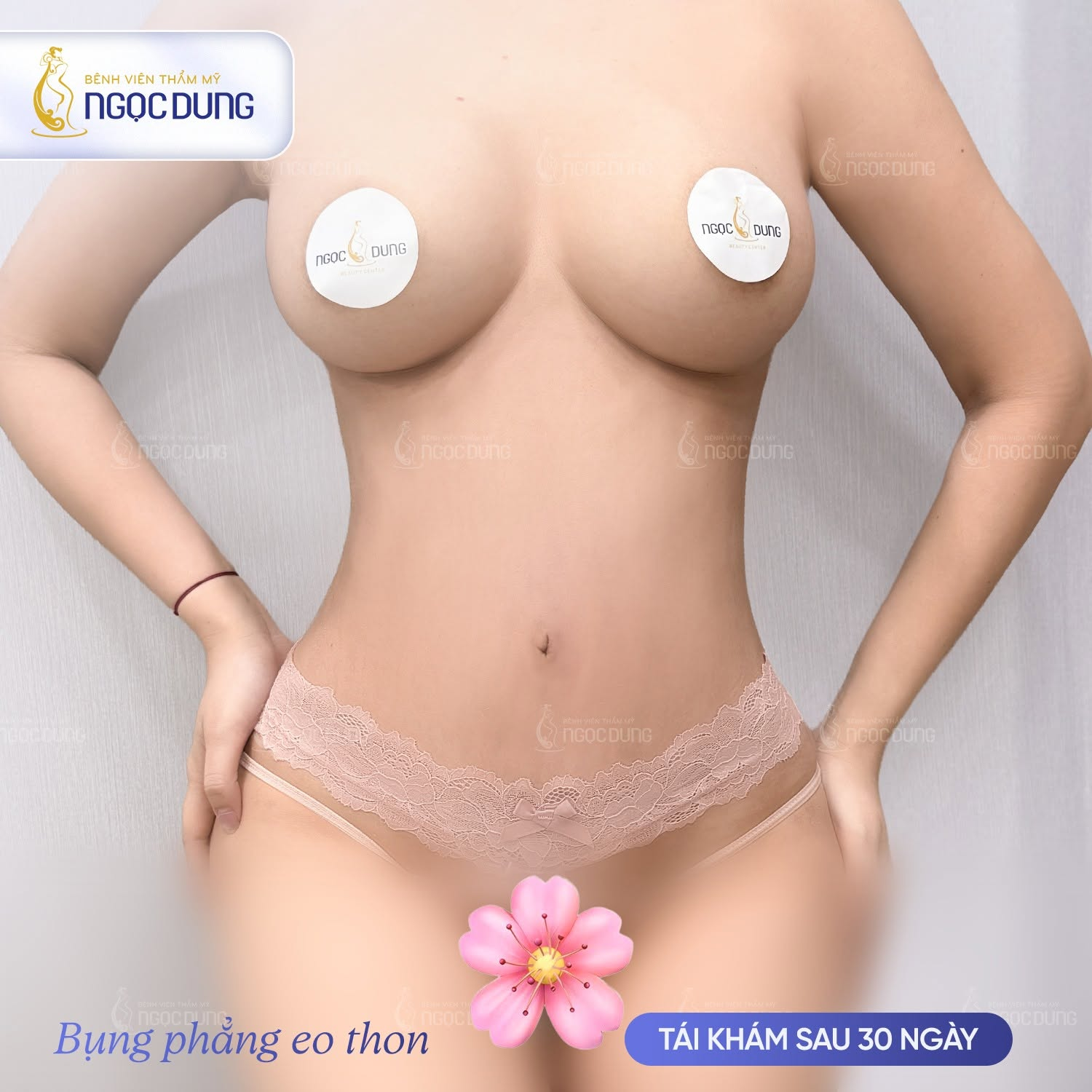 Hút mỡ bụng giá bao nhiêu tiền? Bảng giá cập nhật mới 16 Vóc dáng thon gọn rõ rệt của khách hàng sau khi phẫu thuật hút mỡ bụng tại Ngọc Dung